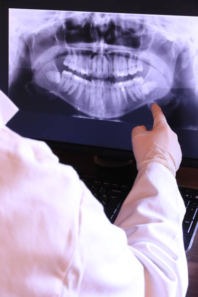 Best Emergency Wisdom Tooth Extraction in Waverly, IA